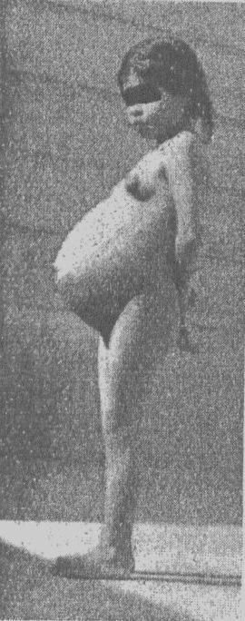 6 ra