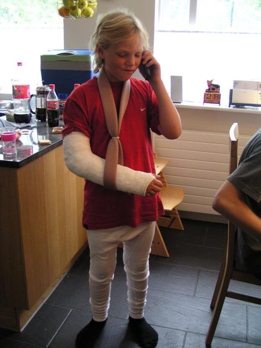 Kominn heim af ttarmti, handleggsbrotinn
