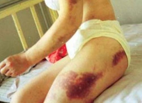 rapevictim 976116.jpg